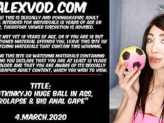 Hotkinkyjo huge ball in ass, prolapse & big anal gape!